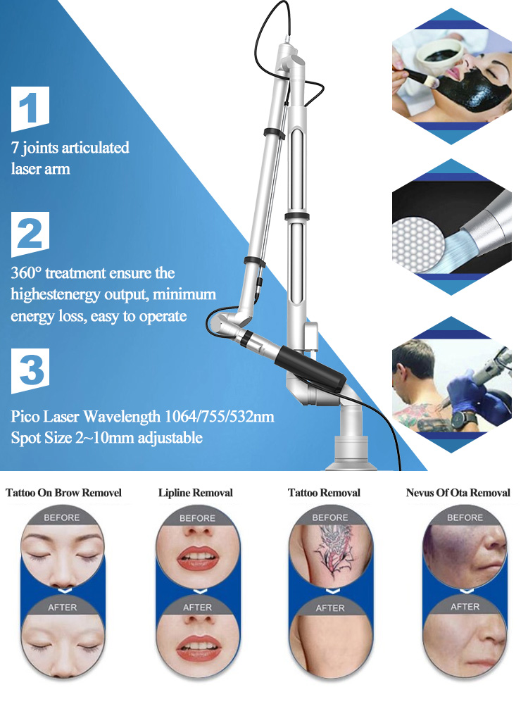 Nd Yag Laser Machine15